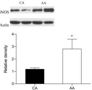 Figure 1 Western blot analysis of (A) phospho-p65 (NF- k B subunit) and (B) I k B- B-a proteins in kidneys at the end of the experiment