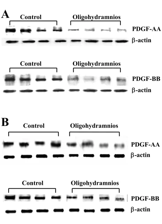 Figure 2 PDGF-AA -actinControl PDGF-BB -actinControlOligohydramniosOligohydramnios Control PDGF-AA -actin Control Oligohydramnios PDGF-BBOligohydramnios -actinAB