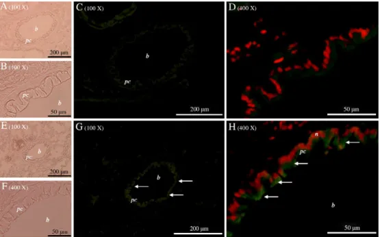 Fig. 5. In vivo inhaled delivery six 100 μg doses of pcDNA3-CFTR/polymeric micelles (PM) with co-administrated with 10% ethanol on nude mice