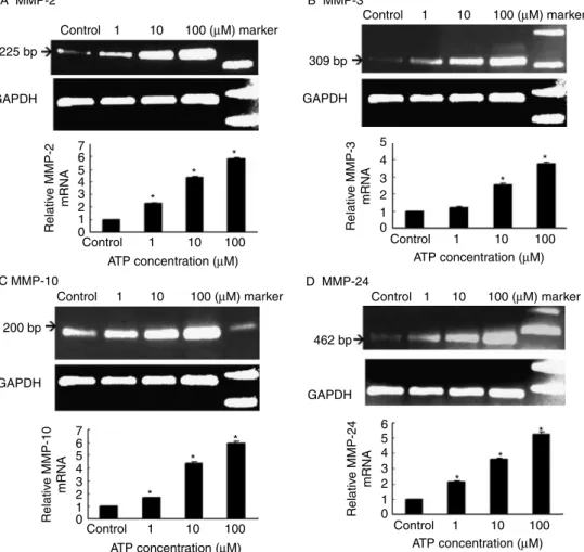 Figure 5 Gene array of human extracellular matrix and adhesion molecules described in Materials and Methods