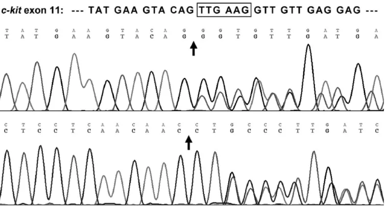 Fig. 3 Molecular analysis of the c-kit gene revealing an in-frame deletion of codons 557 and 558 in exon 11 (arrows)