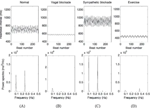 Fig. 3. Simulations for normal condition, vagal blockade, sympathetic blockade and exercise of high intensity