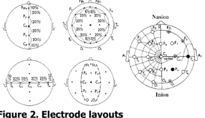 Figure 2. Electrode layouts