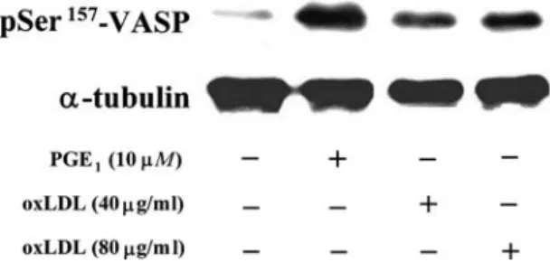Figure 5. Eﬀect of oxLDL on phosphorylation of VASP at Ser 157 in human platelets. Platelets were incubated with  pros-taglandin E 1 (PGE 1 ) (10 lM) and oxLDL (40 and 80 lg/ml),