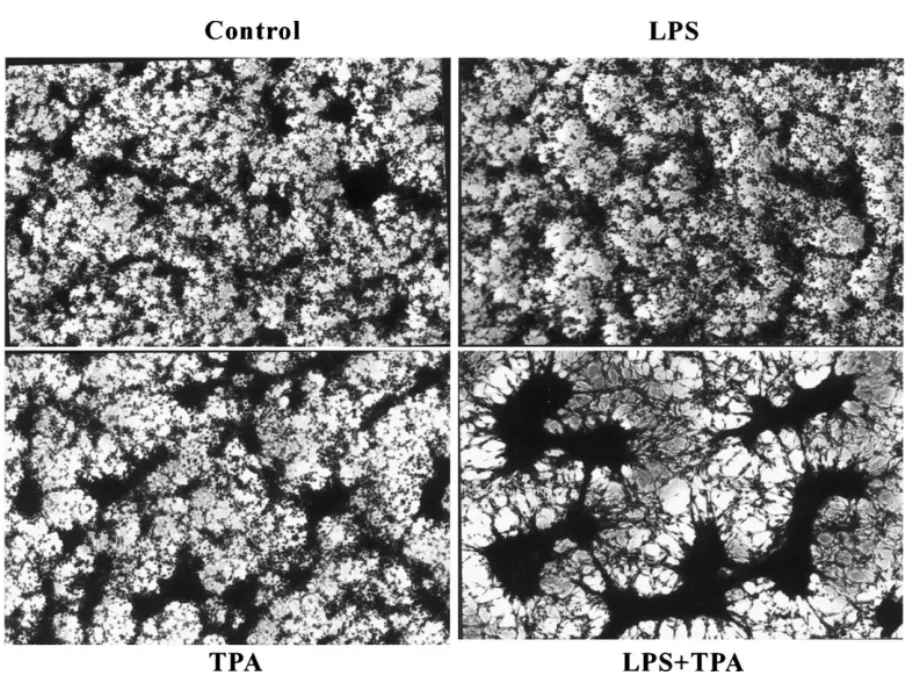 Fig. 2. Transformational morphology observed in LPS/TPA-treated glioma C6 cells. Cells were treated with LPS (1 ␮g/ml), TPA (400 ng/ml) or LPS (1 ␮g/ml) plus TPA (400 ng/ml) (LPS/TPA) for 24 h, followed by Giemsa staining