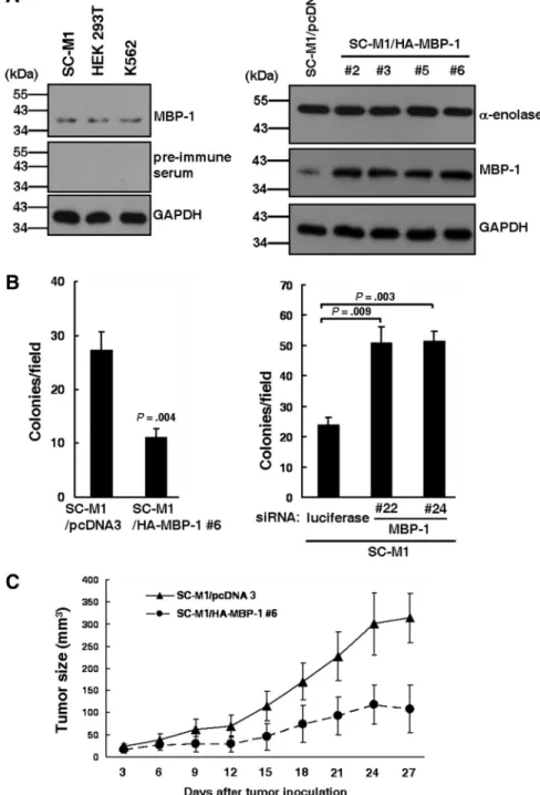 Figure 1. Tumor growth of SC-M1 cells is suppressed by MBP-1. (A) Whole-cell extracts of SC-M1, HEK 293T, and K562 cells were prepared for Western blot analysis using  rab-bit anti–MBP-1 antibody or its pre-immune serum and anti-GAPDH antibody (left)