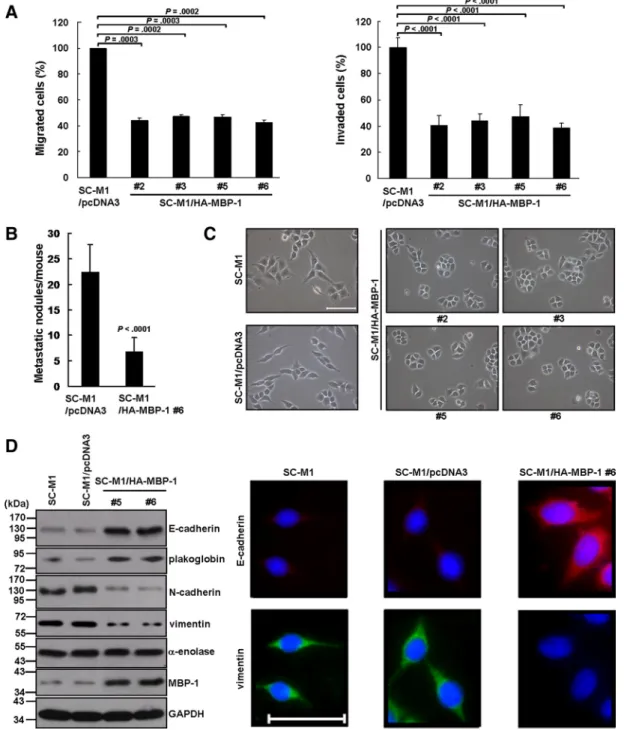 Figure 2. Tumor progression ability of SC-M1 cells are suppressed by MBP-1. (A) SC-M1/HA-MBP-1 cells and control cells were seeded to evaluate migration (left) and invasion (right) abilities