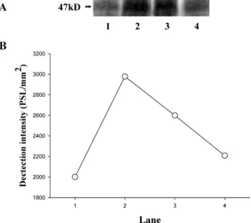 Figure 4. Effect of rutin on phosphorylation of a protein of M r 47000 (P47) in human platelets challenged with collagen