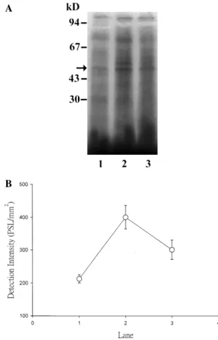 Fig 4. (A) Effect of magnesium sulphate on phosphorylation of a protein of Mr 47 000 (P47) in human platelets challenged with collagen