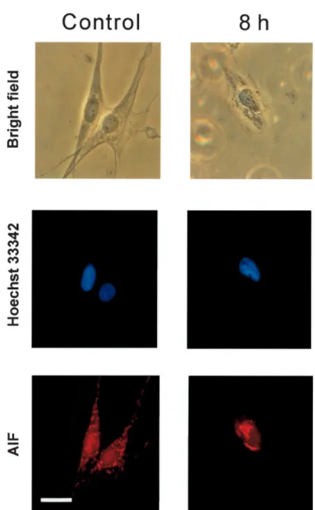 Fig. 6. Translocation of apoptosis-inducing factor (AIF) into the nucleus induced by cadmium