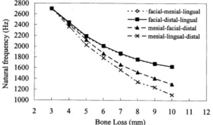 Fig. 6 Changes in the natural frequency value of the model with various types and degrees of  two-sided bone losses