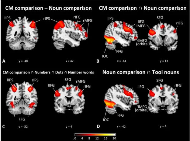 Figure 2. Brain activations from the contrast analysis and conjunction analysis 