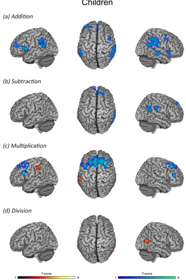 Figure 8. Brain regions that showed significant activation during addition, subtraction, multiplication,  and division in Children