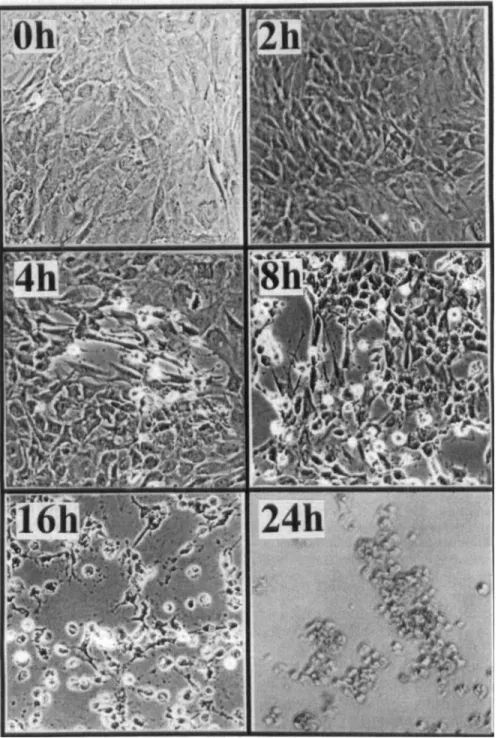 Fig.  1. Effects of SNP on alternations of  osteoblast morphologies. Osteoblasts prepared  from neonatal Wistar rat calvariae were treated with 2  mM  SNP for 0,  2,  4, 8,  16 and 24 h