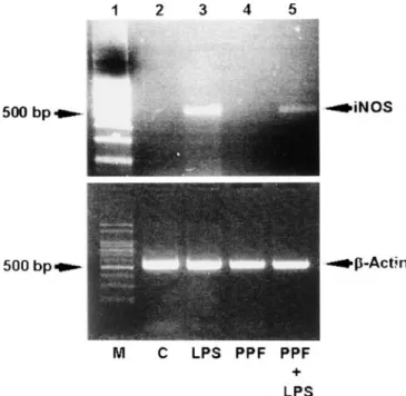 Fig. 4 RT-PCR analysis of inducible nitric oxide synthase (iNOS) from untreated (C) macrophages, and those treated with  lipopoly-saccharide (LPS), propofol (PPF), or a combination of PPF and LPS
