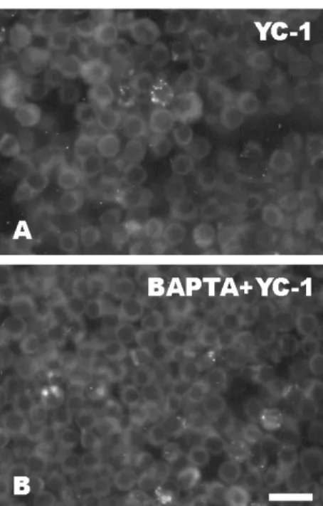 Fig. 1. 顯示 BAPTA/AM 對 YC-1 刺激脂質分解的影響之 Nile red 染色結果。含 有脂肪的細胞在 (A) 沒有 或 (B) 有 60 M BAPTA/AM 前處理 30 分鐘，接著 再用 60 M YC-1 作用 6 小時以誘導脂質分解。處理後的細胞經過固定後便用 Nile red 加以染色。Bar = 20 m。