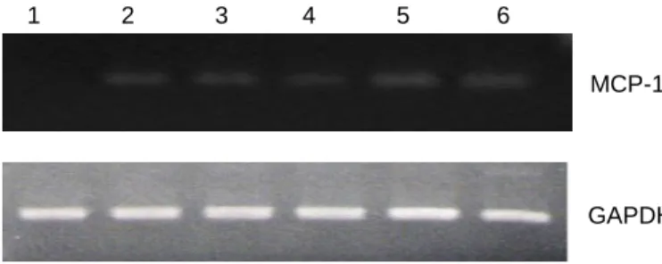 Figure 2. Effects of triptolide on IL-1-induced MCP-1 gene expression. Total RNA was extracted from SW1353 cells treated with or without 5 ng/ml IL-1and various concentrations of triptolide for 6 hours