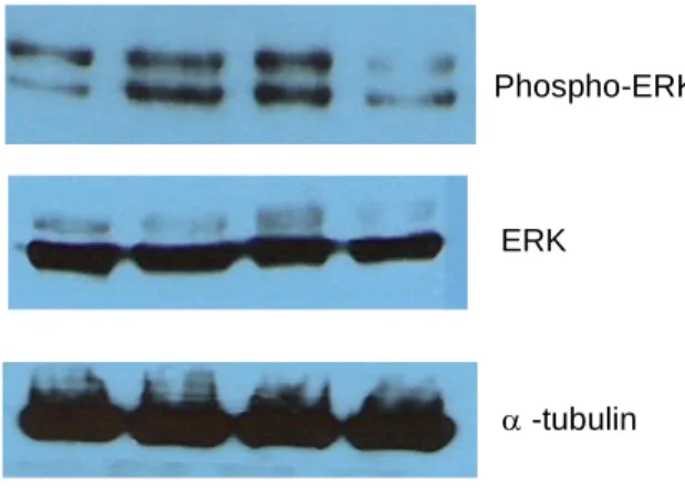 Figure 4. Effects of triptolide on IL-1-induced ERK1/2 activation. Total protein was extracted from SW1353 cells treated with or without 5 ng/ml IL-1 and various concentrations of triptolide for 1 hour