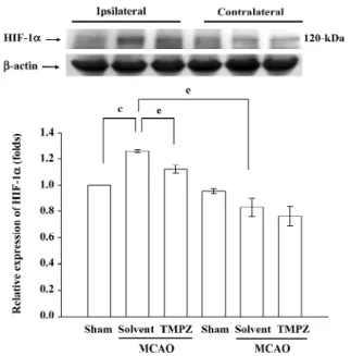 Figure 2.  Protective effect of TMPZ in MCAO-induced rats with
