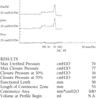 Fig 6. The representative urodynamic datashowed the maximum closure pressure of 77cmH2O in pressure profiles.