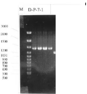 Figure 17. Screening of cDNA clones harboring the 1.2  kb fragment with colony PCR method