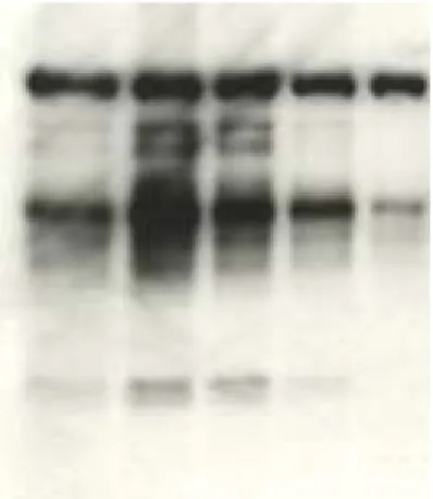 Figure 4B     H-89, a PKA inhibitor, suppress the PAF-induced  mouse sperm capacitation associated protein tyrosine  phosphorylation  PAF(M)             0   10 -7     10 -6     10 -5     10 -5     10 -5     10 -5     10 -5     10 -5SVA/SVDF (mg/ml)   0    