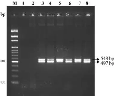 Fig. 3. Polymerase chain reaction (PCR) products amplified from total DNA of strains E