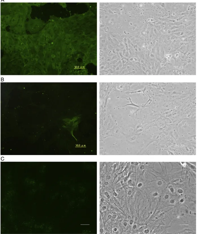 Fig. 5. Expression of neuronal proteins in GBC4 cells. Cells similar to those in Fig. 2 were stained with mouse monoclonal antibodies against TH (A), MAP2 (B) or Cx35 (C)