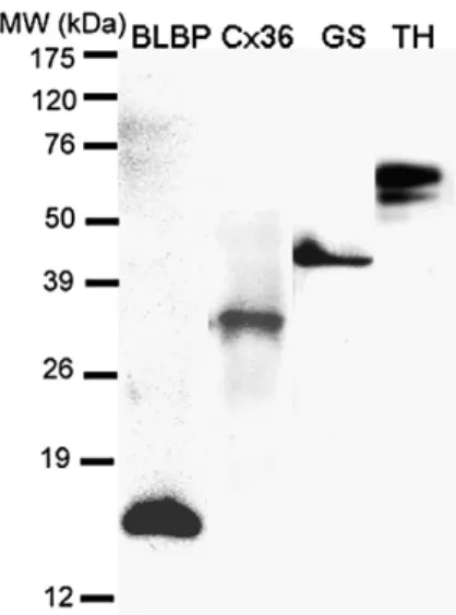 Fig. 7. Reaction of monoclonal anti-GFAP with grouper brain extract (BE) and GBC4 cell extract (CE).