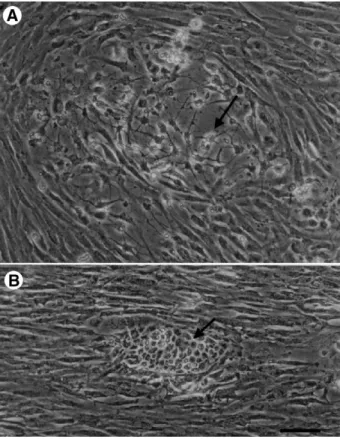 Fig. 5. Phase contrast micrographs of TB2 cells at the ninth passage grown in low-serum and normal medium