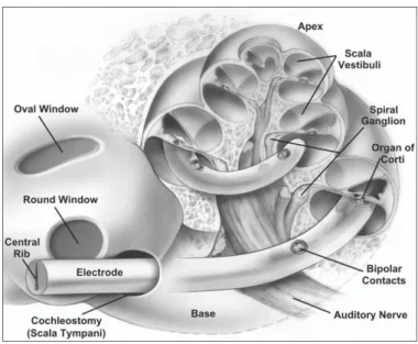 Figure 1.4 The electrode array is usually implanted in the scala tympani along BM, which located close to  the auditory nerve