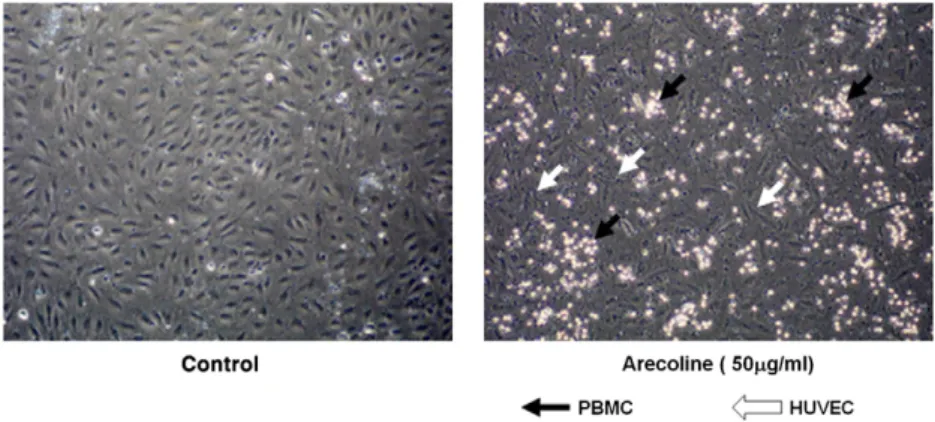 Fig. 4. A HO-1 inhibitor increases arecoline-induced ROS production and ICAM and VCAM expression