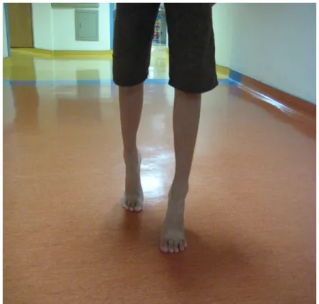 圖 3-4-10  踝關節蹠曲的肌力，以墊腳尖行走來測試。 