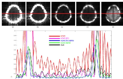 Fig. 1 Projection images of MRSI data of (a)NOVS (b) NOVS with PG (c) NOVS 