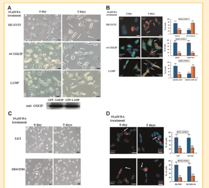 Fig. 1. Inhibition of GSK3b activity prevents SH-SY5Y cell differentiation in response to retinoic acid (RA) treatment