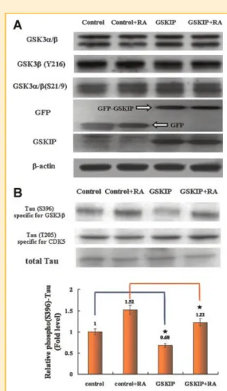 Fig. 2. GSKIP affects GSK3b activity phosphorylating a specific site of tau during RA treatment of SH-SY5Y cells