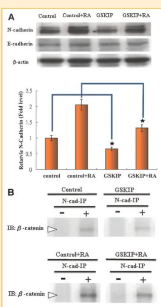Fig. 5. GSKIP downregulates N-cadherin expression and reduces recruitment of cytoplasmic b-catenin