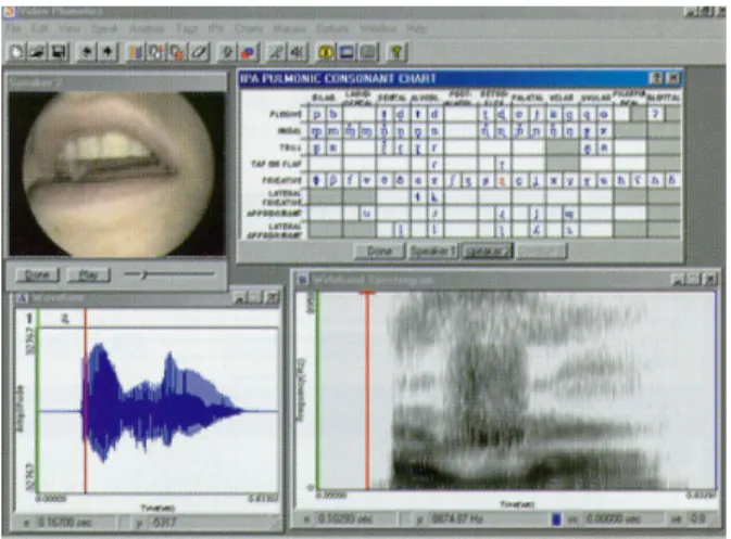 圖 5-2-3 Multi-Speech 3700 語音分析圖  資料來源：PENTAX Medical Company。