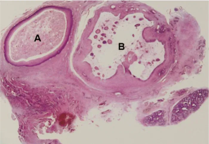 Figure 2.  A low power photomicrograph shows the specimen and the two