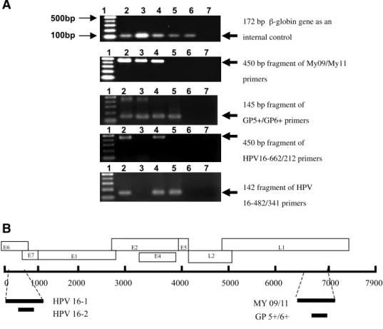 Figure 1. A. Different fragments of HPV DNA and human h-globin gene were amplified from different subjects, Caski cell line (HPV-16), and Hep2 cell line (HPV-18) as positive controls and distilled water as a negative control