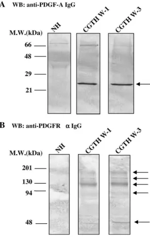 Fig. 4. Detection of PDGF-A and PDGFR-a by Western blotting. (A) The approximate 26 kDa PDGF-A protein was detected with mouse monoclonal IgG 2b anti-PDGF-A in nodular hyperplasia