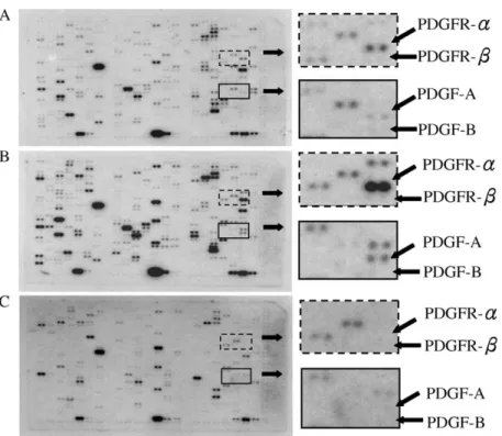 Fig. 2. Expression pattern of genes in follicular thyroid carcinoma cell line, papillary thyroid carcinoma cell line, and nodular hyperplasia