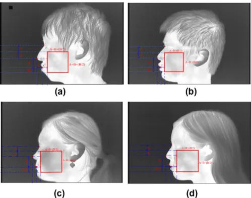 Fig. 3. The ambit of individual cheek square at thermal lateral face image.