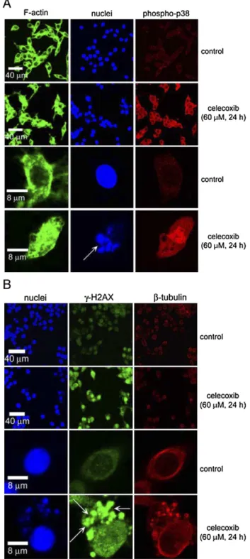 Fig. 5. The effect of celecoxib on the expression and location of phosphorylated p38 MAP kinase and γ-H2AX