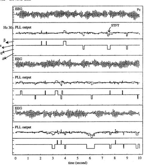 Figure  7. Result of tracking the dominant frequency of a 30-s EEG (at Pz) with alpha dominating