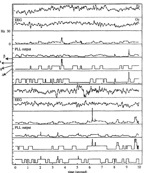 Figure  8. Result of tracking the dominant frequency of a 20-s, two-channel EEG (Fz and Oz) with  slow waves dominating