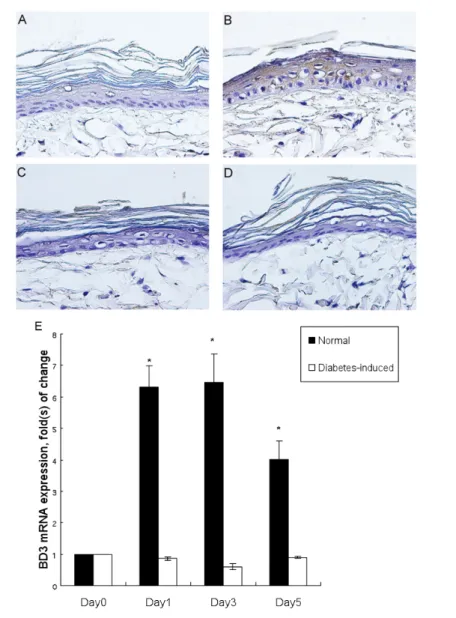 Figure 1. Expression of BD3 in wounded rat skin. (A–D) Immunohistochemical BD3 staining (brown) of the perilesional skin of the control (A, B) and the diabetic rat (C, D) at day 0 and 3 after wounding respectively