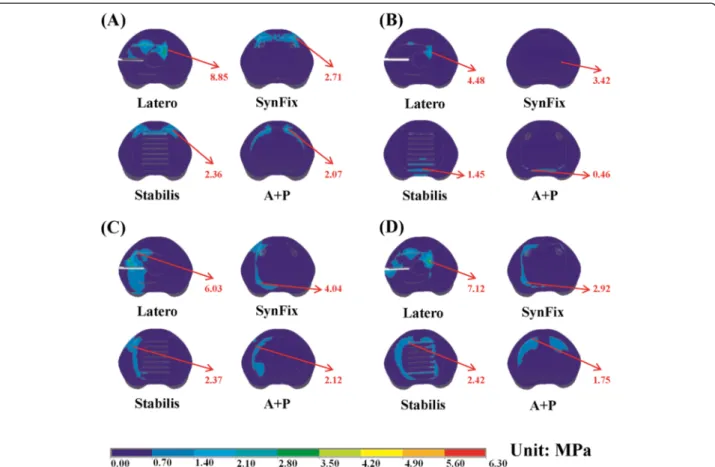 Figure 8 Distribution of endplate stress on the upper surface of the L4 vertebra for all models
