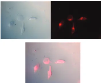 Fig. 8 Hg 2+ -treated HeLa cell images. (Top left) Bright ﬁeld image; (Top right) ﬂuorescence image; and (Bottom) merged image.