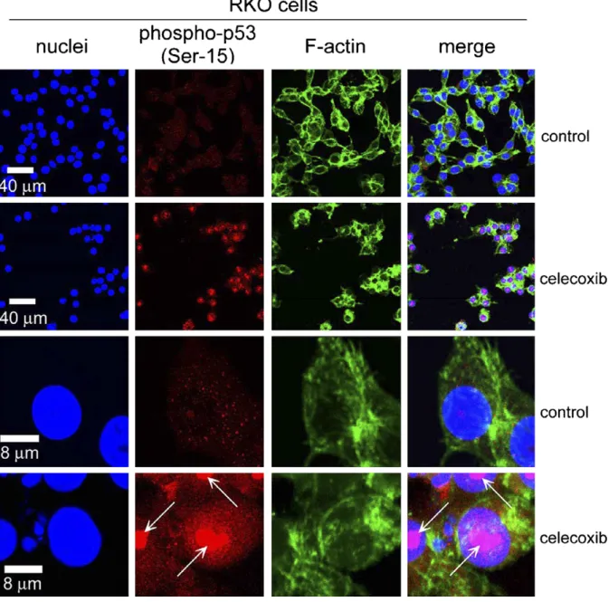 Fig. 4. The expression and localization of phospho-p53 (serine-15) proteins following treatment with celecoxib in RKO cells